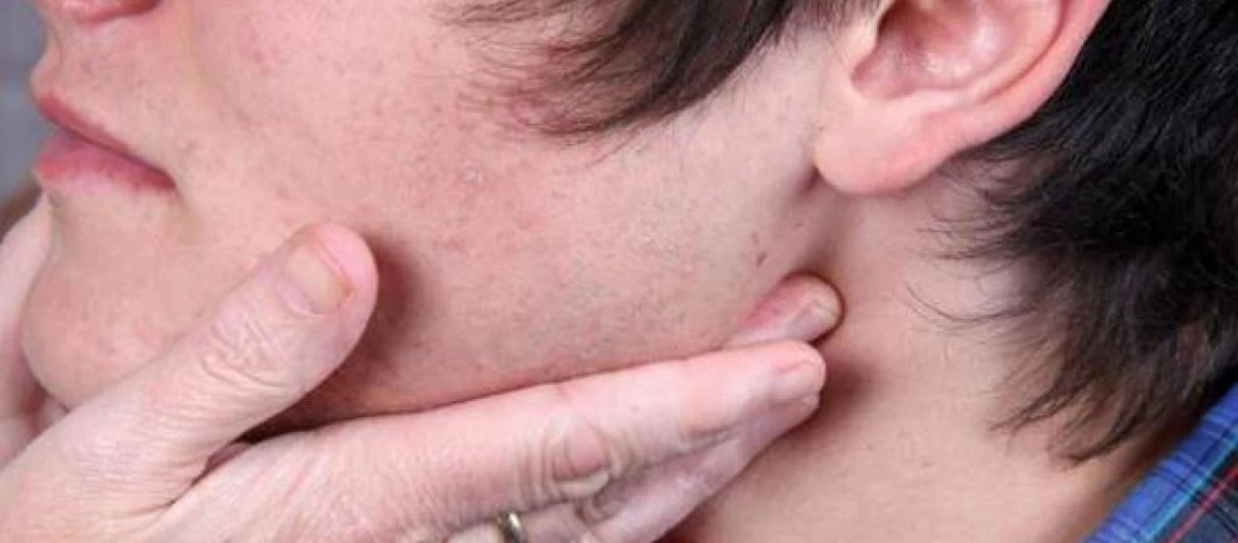 Λέμφωμα: Το νου σας σε αυτά τα «αθώα» συμπτώματα - Πως να κάνετε την αυτοεξέταση (βίντεο)